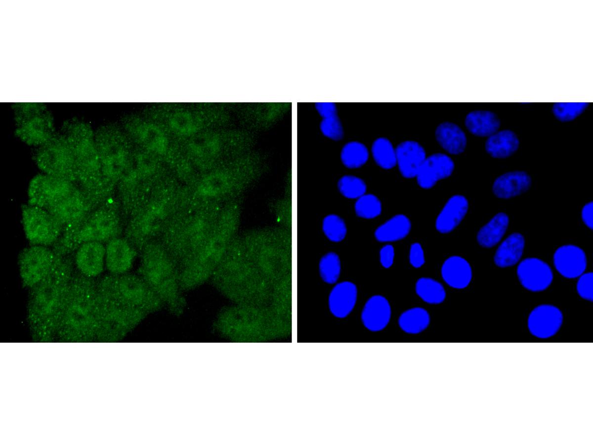 ICC staining of Caspase-8 in HepG2 cells (green). Formalin fixed cells were permeabilized with 0.1% Triton X-100 in TBS for 10 minutes at room temperature and blocked with 1% Blocker BSA for 15 minutes at room temperature. Cells were probed with the primary antibody (ET1603-16, 1/50) for 1 hour at room temperature, washed with PBS. Alexa Fluor®488 Goat anti-Rabbit IgG was used as the secondary antibody at 1/1,000 dilution. The nuclear counter stain is DAPI (blue).