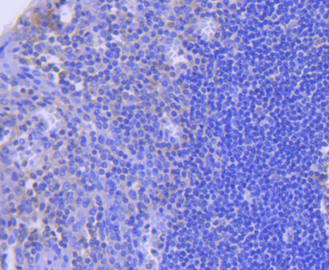 Immunohistochemical analysis of paraffin-embedded human tonsil tissue using anti-Caspase-8 antibody. The section was pre-treated using heat mediated antigen retrieval with Tris-EDTA buffer (pH 8.0-8.4) for 20 minutes.The tissues were blocked in 5% BSA for 30 minutes at room temperature, washed with ddH2O and PBS, and then probed with the primary antibody (ET1603-16, 1/50) for 30 minutes at room temperature. The detection was performed using an HRP conjugated compact polymer system. DAB was used as the chromogen. Tissues were counterstained with hematoxylin and mounted with DPX.