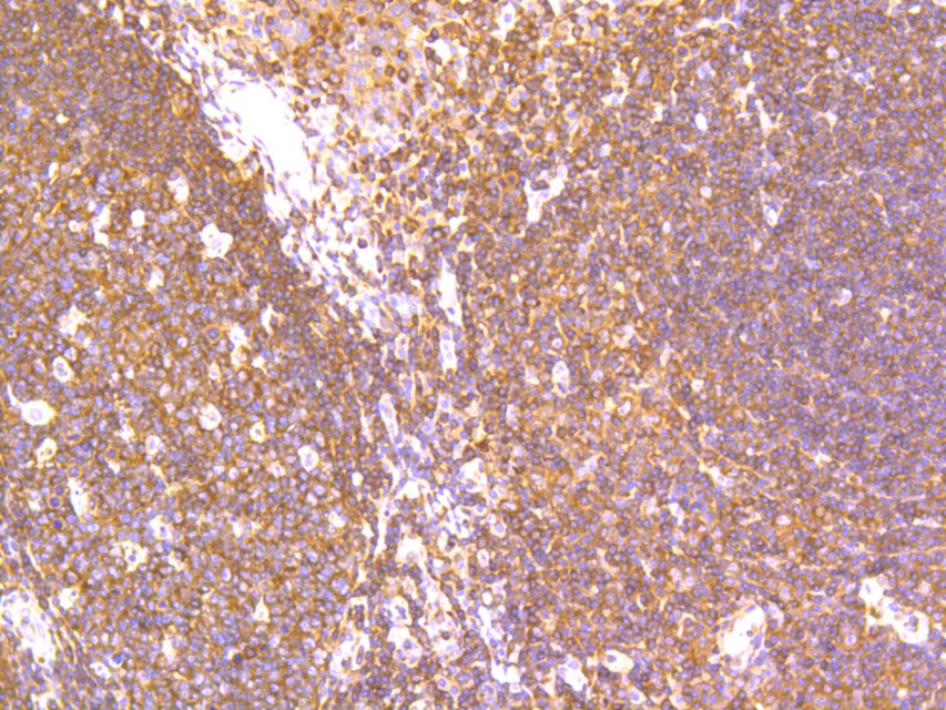 Immunohistochemical analysis of paraffin-embedded human spleen tissue using anti-NFkB p105/p50 antibody. The section was pre-treated using heat mediated antigen retrieval with Tris-EDTA buffer (pH 8.0-8.4) for 20 minutes.The tissues were blocked in 5% BSA for 30 minutes at room temperature, washed with ddH2O and PBS, and then probed with the primary antibody (ET1603-18, 1/200) for 30 minutes at room temperature. The detection was performed using an HRP conjugated compact polymer system. DAB was used as the chromogen. Tissues were counterstained with hematoxylin and mounted with DPX.