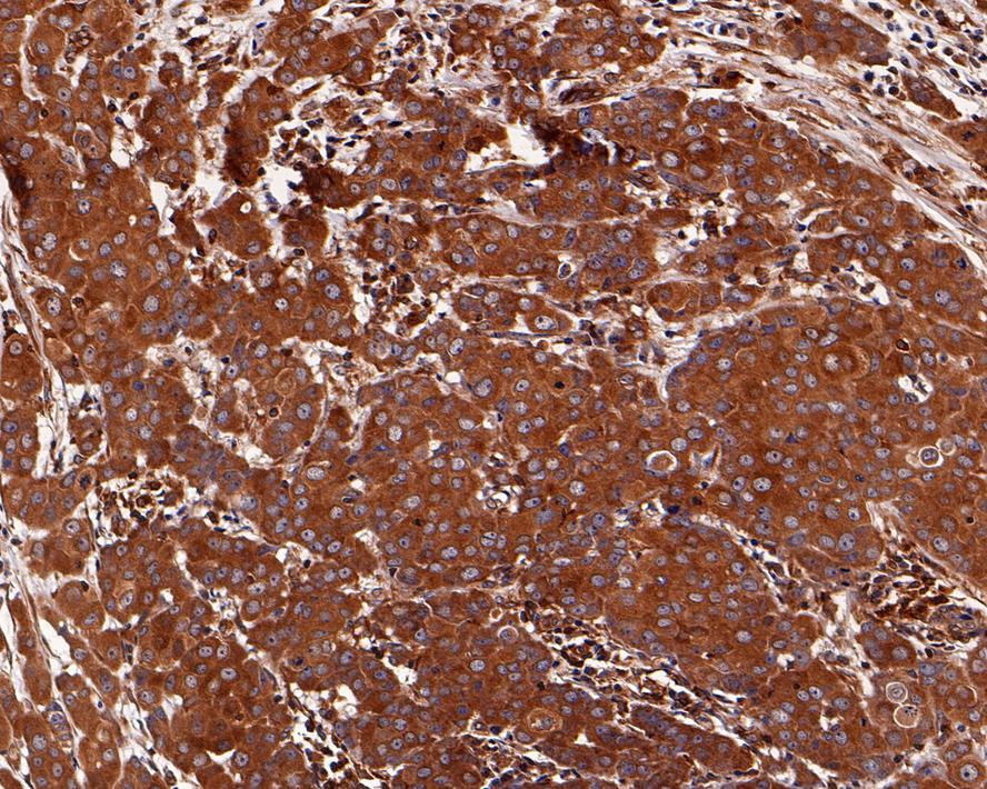 Immunohistochemical analysis of paraffin-embedded mouse bladder tissue using anti-NFkB p105/p50 antibody. The section was pre-treated using heat mediated antigen retrieval with Tris-EDTA buffer (pH 8.0-8.4) for 20 minutes.The tissues were blocked in 5% BSA for 30 minutes at room temperature, washed with ddH2O and PBS, and then probed with the primary antibody (ET1603-18, 1/50) for 30 minutes at room temperature. The detection was performed using an HRP conjugated compact polymer system. DAB was used as the chromogen. Tissues were counterstained with hematoxylin and mounted with DPX.