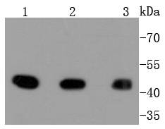 Western blot analysis of MEK1 on different lysates. Proteins were transferred to a PVDF membrane and blocked with 5% BSA in PBS for 1 hour at room temperature. The primary antibody (ET1603-20, 1/500) was used in 5% BSA at room temperature for 2 hours. Goat Anti-Rabbit IgG - HRP Secondary Antibody (HA1001) at 1:5,000 dilution was used for 1 hour at room temperature.<br />
Positive control: <br />
Lane 1: A431 cell lysate<br />
Lane 2: HepG2 cell lysate <br />
Lane 3: Hela cell lysate
