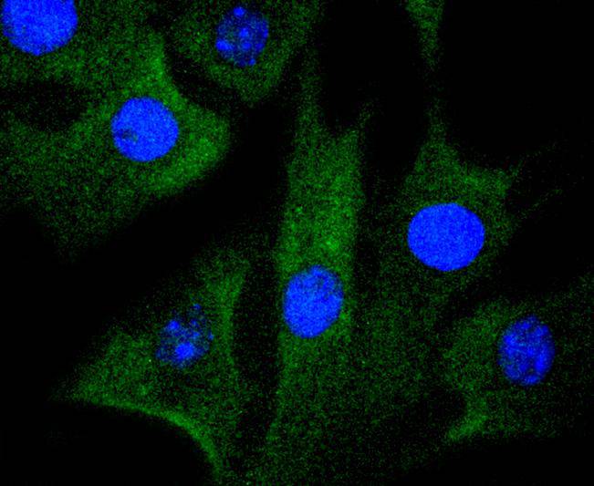 ICC staining of MEK1 in NIH/3T3 cells (green). Formalin fixed cells were permeabilized with 0.1% Triton X-100 in TBS for 10 minutes at room temperature and blocked with 1% Blocker BSA for 15 minutes at room temperature. Cells were probed with the primary antibody (ET1603-20, 1/50) for 1 hour at room temperature, washed with PBS. Alexa Fluor®488 Goat anti-Rabbit IgG was used as the secondary antibody at 1/1,000 dilution. The nuclear counter stain is DAPI (blue).