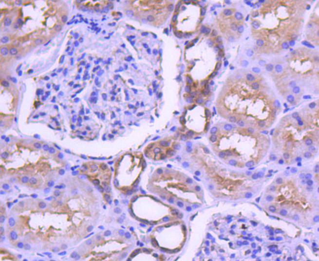 Immunohistochemical analysis of paraffin-embedded human kidney tissue using anti-MEK1 antibody. The section was pre-treated using heat mediated antigen retrieval with Tris-EDTA buffer (pH 8.0-8.4) for 20 minutes.The tissues were blocked in 5% BSA for 30 minutes at room temperature, washed with ddH2O and PBS, and then probed with the primary antibody (ET1603-20, 1/50) for 30 minutes at room temperature. The detection was performed using an HRP conjugated compact polymer system. DAB was used as the chromogen. Tissues were counterstained with hematoxylin and mounted with DPX.