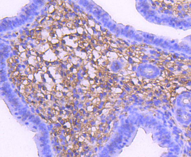 Immunohistochemical analysis of paraffin-embedded mouse uterus tissue using anti-MEK1 antibody. The section was pre-treated using heat mediated antigen retrieval with Tris-EDTA buffer (pH 8.0-8.4) for 20 minutes.The tissues were blocked in 5% BSA for 30 minutes at room temperature, washed with ddH2O and PBS, and then probed with the primary antibody (ET1603-20, 1/50) for 30 minutes at room temperature. The detection was performed using an HRP conjugated compact polymer system. DAB was used as the chromogen. Tissues were counterstained with hematoxylin and mounted with DPX.