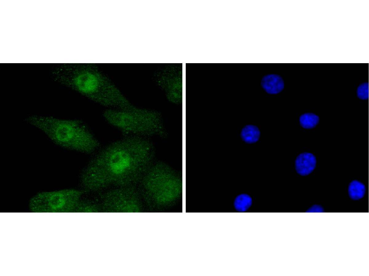 ICC staining of Phospho-Erk1(T202)+Erk2(T185) in NIH/3T3 cells (green). Formalin fixed cells were permeabilized with 0.1% Triton X-100 in TBS for 10 minutes at room temperature and blocked with 1% Blocker BSA for 15 minutes at room temperature. Cells were probed with the primary antibody (ET1603-22, 1/50) for 1 hour at room temperature, washed with PBS. Alexa Fluor®488 Goat anti-Rabbit IgG was used as the secondary antibody at 1/1,000 dilution. The nuclear counter stain is DAPI (blue).