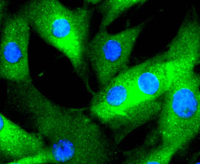 ICC staining of Phospho-Erk1(T202)+Erk2(T185) in MCF-7 cells (green). Formalin fixed cells were permeabilized with 0.1% Triton X-100 in TBS for 10 minutes at room temperature and blocked with 1% Blocker BSA for 15 minutes at room temperature. Cells were probed with the primary antibody (ET1603-22, 1/50) for 1 hour at room temperature, washed with PBS. Alexa Fluor®488 Goat anti-Rabbit IgG was used as the secondary antibody at 1/1,000 dilution. The nuclear counter stain is DAPI (blue).