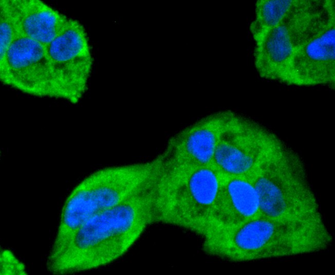 ICC staining of ERK2 in Hela cells (green). Formalin fixed cells were permeabilized with 0.1% Triton X-100 in TBS for 10 minutes at room temperature and blocked with 1% Blocker BSA for 15 minutes at room temperature. Cells were probed with the primary antibody (ET1603-23, 1/50) for 1 hour at room temperature, washed with PBS. Alexa Fluor®488 Goat anti-Rabbit IgG was used as the secondary antibody at 1/1,000 dilution. The nuclear counter stain is DAPI (blue).
