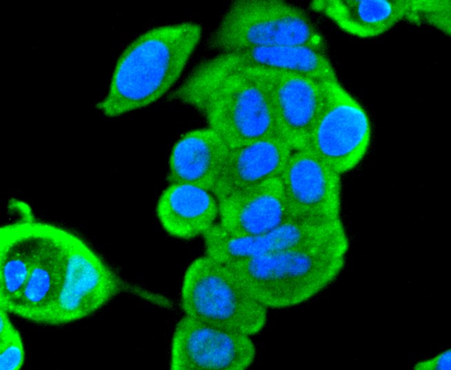 ICC staining of ERK2 in MCF-7 cells (green). Formalin fixed cells were permeabilized with 0.1% Triton X-100 in TBS for 10 minutes at room temperature and blocked with 1% Blocker BSA for 15 minutes at room temperature. Cells were probed with the primary antibody (ET1603-23, 1/50) for 1 hour at room temperature, washed with PBS. Alexa Fluor®488 Goat anti-Rabbit IgG was used as the secondary antibody at 1/1,000 dilution. The nuclear counter stain is DAPI (blue).