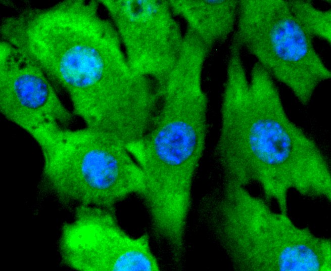 ICC staining of ERK2 in NIH/3T3 cells (green). Formalin fixed cells were permeabilized with 0.1% Triton X-100 in TBS for 10 minutes at room temperature and blocked with 1% Blocker BSA for 15 minutes at room temperature. Cells were probed with the primary antibody (ET1603-23, 1/50) for 1 hour at room temperature, washed with PBS. Alexa Fluor®488 Goat anti-Rabbit IgG was used as the secondary antibody at 1/1,000 dilution. The nuclear counter stain is DAPI (blue).