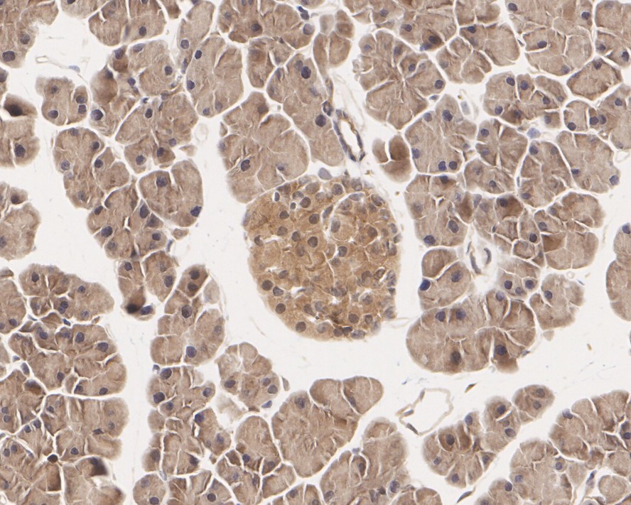 Immunohistochemical analysis of paraffin-embedded mouse stomach tissue using anti-ERK2 antibody. The section was pre-treated using heat mediated antigen retrieval with Tris-EDTA buffer (pH 8.0-8.4) for 20 minutes.The tissues were blocked in 5% BSA for 30 minutes at room temperature, washed with ddH2O and PBS, and then probed with the primary antibody (ET1603-23, 1/50) for 30 minutes at room temperature. The detection was performed using an HRP conjugated compact polymer system. DAB was used as the chromogen. Tissues were counterstained with hematoxylin and mounted with DPX.