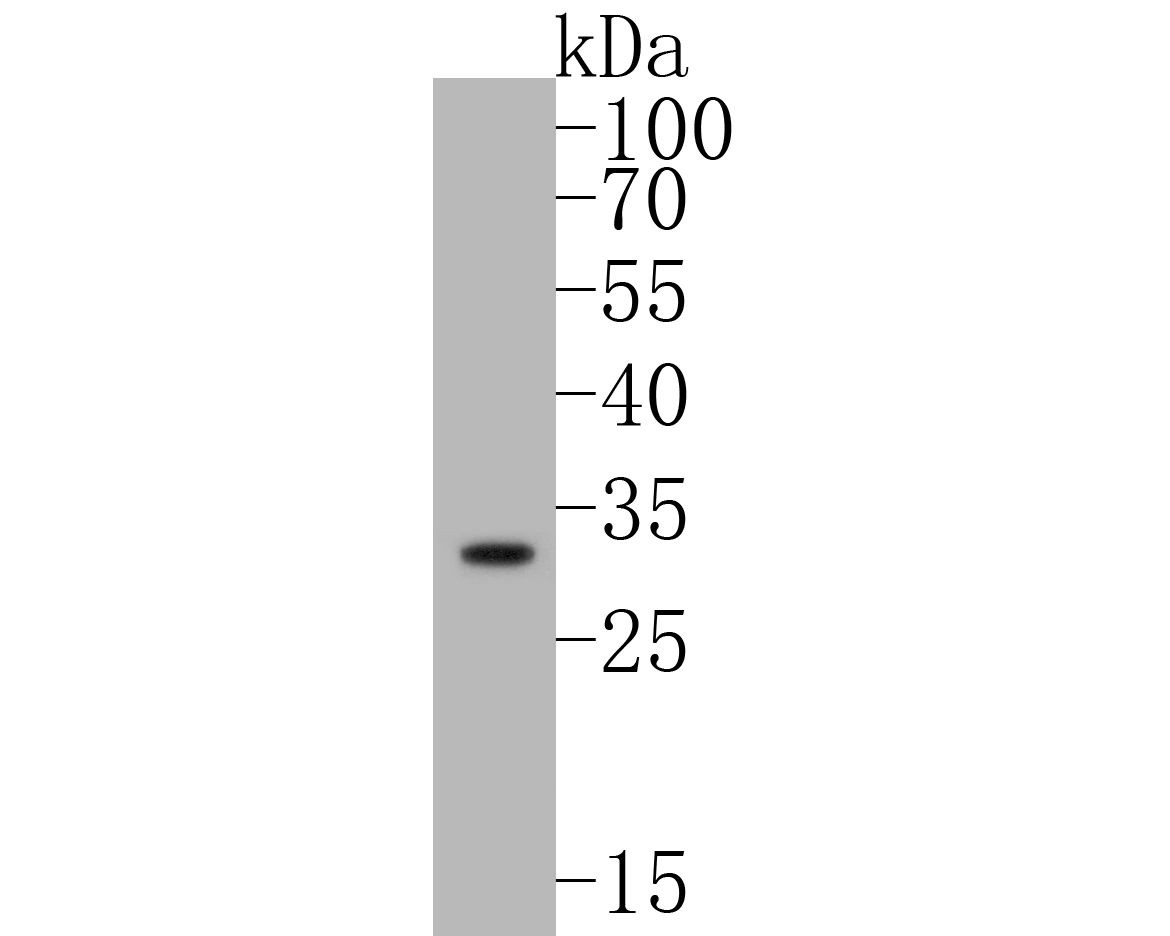 Western blot analysis of pro Caspase-3 on Jurkat cell lysates. Proteins were transferred to a PVDF membrane and blocked with 5% BSA in PBS for 1 hour at room temperature. The primary antibody (ET1603-26, 1/500) was used in 5% BSA at room temperature for 2 hours. Goat Anti-Rabbit IgG - HRP Secondary Antibody (HA1001) at 1:5,000 dilution was used for 1 hour at room temperature.