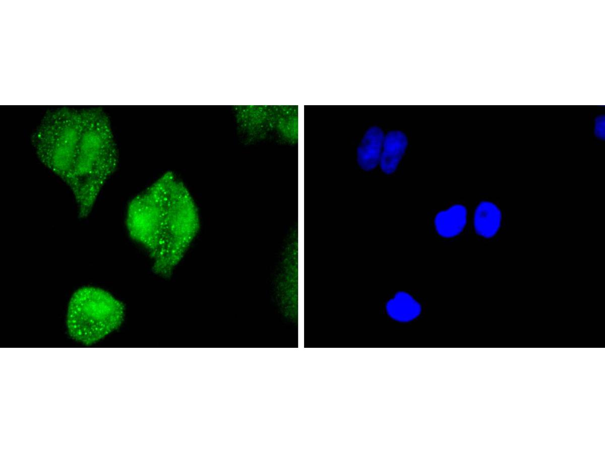ICC staining of pro Caspase-3 in Hela cells (green). Formalin fixed cells were permeabilized with 0.1% Triton X-100 in TBS for 10 minutes at room temperature and blocked with 1% Blocker BSA for 15 minutes at room temperature. Cells were probed with the primary antibody (ET1603-26, 1/50) for 1 hour at room temperature, washed with PBS. Alexa Fluor®488 Goat anti-Rabbit IgG was used as the secondary antibody at 1/1,000 dilution. The nuclear counter stain is DAPI (blue).