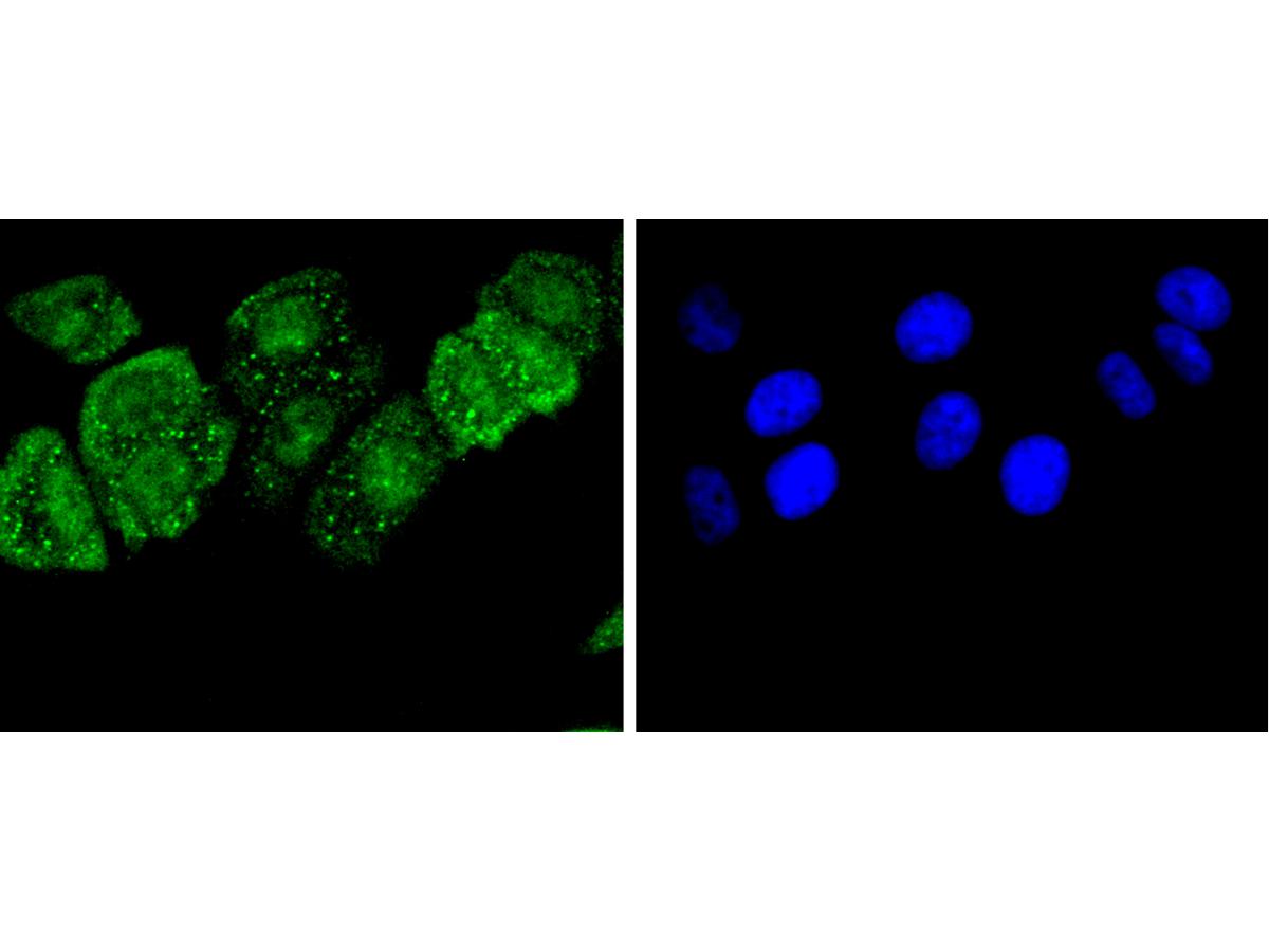 ICC staining of pro Caspase-3 in MCF-7 cells (green). Formalin fixed cells were permeabilized with 0.1% Triton X-100 in TBS for 10 minutes at room temperature and blocked with 1% Blocker BSA for 15 minutes at room temperature. Cells were probed with the primary antibody (ET1603-26, 1/50) for 1 hour at room temperature, washed with PBS. Alexa Fluor®488 Goat anti-Rabbit IgG was used as the secondary antibody at 1/1,000 dilution. The nuclear counter stain is DAPI (blue).