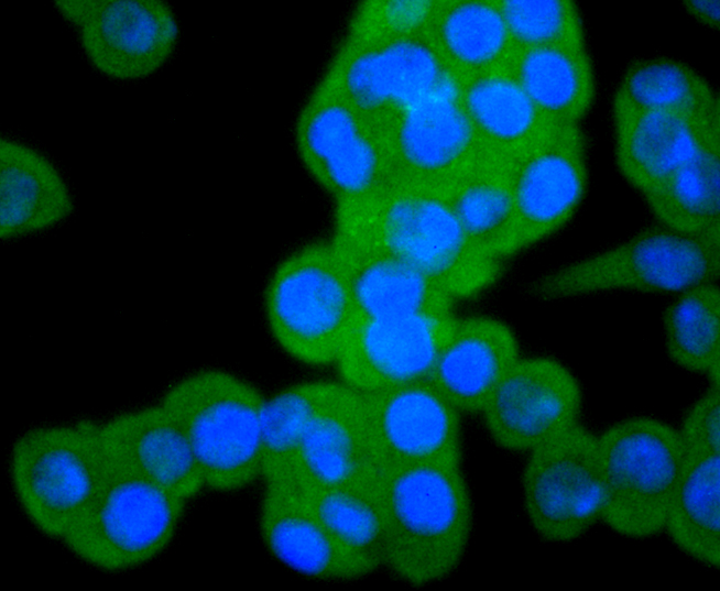 ICC staining of pro Caspase-3 in SW480 cells (green). Formalin fixed cells were permeabilized with 0.1% Triton X-100 in TBS for 10 minutes at room temperature and blocked with 1% Blocker BSA for 15 minutes at room temperature. Cells were probed with the primary antibody (ET1603-26, 1/50) for 1 hour at room temperature, washed with PBS. Alexa Fluor®488 Goat anti-Rabbit IgG was used as the secondary antibody at 1/1,000 dilution. The nuclear counter stain is DAPI (blue).