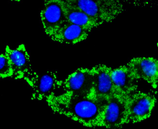 ICC staining of Caspase-9 in A549 cells (green). Formalin fixed cells were permeabilized with 0.1% Triton X-100 in TBS for 10 minutes at room temperature and blocked with 1% Blocker BSA for 15 minutes at room temperature. Cells were probed with the primary antibody (ET1603-27, 1/100) for 1 hour at room temperature, washed with PBS. Alexa Fluor®488 Goat anti-Rabbit IgG was used as the secondary antibody at 1/1,000 dilution. The nuclear counter stain is DAPI (blue).