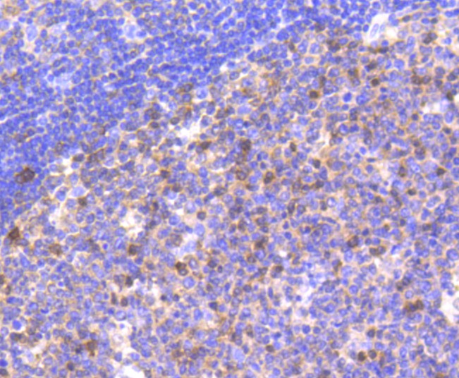 Immunohistochemical analysis of paraffin-embedded human tonsil tissue using anti-Caspase-9 antibody. The section was pre-treated using heat mediated antigen retrieval with Tris-EDTA buffer (pH 8.0-8.4) for 20 minutes.The tissues were blocked in 5% BSA for 30 minutes at room temperature, washed with ddH2O and PBS, and then probed with the primary antibody (ET1603-27, 1/50) for 30 minutes at room temperature. The detection was performed using an HRP conjugated compact polymer system. DAB was used as the chromogen. Tissues were counterstained with hematoxylin and mounted with DPX.