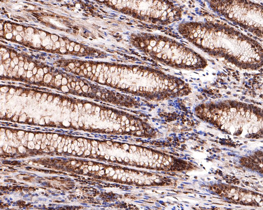 Immunohistochemical analysis of paraffin-embedded human colon tissue with Rabbit anti-Caspase-9 antibody (ET1603-27) at 1/400 dilution.<br />
<br />
The section was pre-treated using heat mediated antigen retrieval with sodium citrate buffer (pH 6.0) for 2 minutes. The tissues were blocked in 1% BSA for 20 minutes at room temperature, washed with ddH2O and PBS, and then probed with the primary antibody (ET1603-27) at 1/400 dilution for 1 hour at room temperature. The detection was performed using an HRP conjugated compact polymer system. DAB was used as the chromogen. Tissues were counterstained with hematoxylin and mounted with DPX.