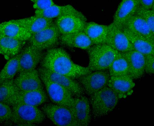 ICC staining of Bcl-XL in HepG2 cells (green). Formalin fixed cells were permeabilized with 0.1% Triton X-100 in TBS for 10 minutes at room temperature and blocked with 1% Blocker BSA for 15 minutes at room temperature. Cells were probed with the primary antibody (ET1603-28, 1/50) for 1 hour at room temperature, washed with PBS. Alexa Fluor®488 Goat anti-Rabbit IgG was used as the secondary antibody at 1/1,000 dilution. The nuclear counter stain is DAPI (blue).