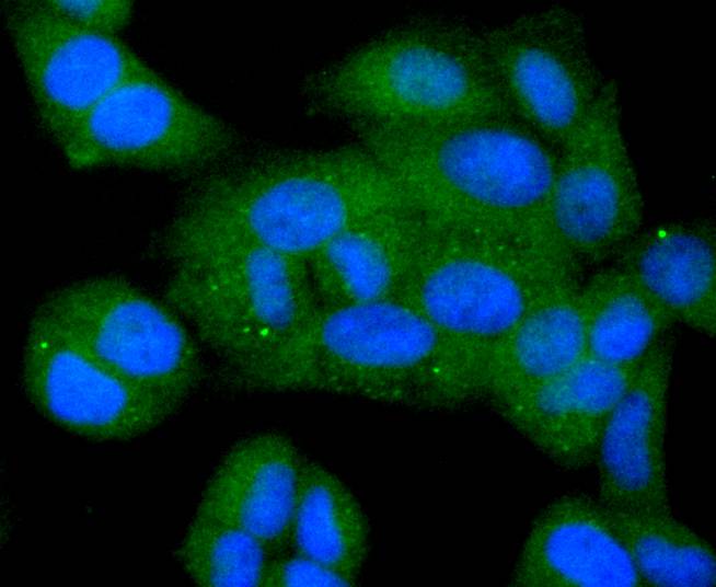 ICC staining of Bcl-XL in Hela cells (green). Formalin fixed cells were permeabilized with 0.1% Triton X-100 in TBS for 10 minutes at room temperature and blocked with 1% Blocker BSA for 15 minutes at room temperature. Cells were probed with the primary antibody (ET1603-28, 1/50) for 1 hour at room temperature, washed with PBS. Alexa Fluor®488 Goat anti-Rabbit IgG was used as the secondary antibody at 1/1,000 dilution. The nuclear counter stain is DAPI (blue).