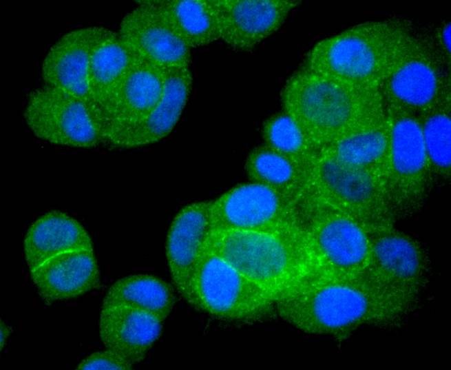 ICC staining of Bcl-XL in MCF-7 cells (green). Formalin fixed cells were permeabilized with 0.1% Triton X-100 in TBS for 10 minutes at room temperature and blocked with 1% Blocker BSA for 15 minutes at room temperature. Cells were probed with the primary antibody (ET1603-28, 1/50) for 1 hour at room temperature, washed with PBS. Alexa Fluor®488 Goat anti-Rabbit IgG was used as the secondary antibody at 1/1,000 dilution. The nuclear counter stain is DAPI (blue).