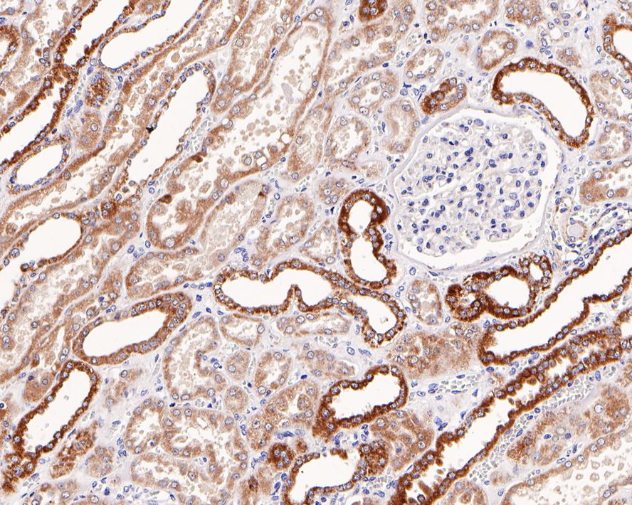Immunohistochemical analysis of paraffin-embedded human kidney tissue with Rabbit anti-Bcl-XL antibody (ET1603-28) at 1/1,000 dilution.<br />
<br />
The section was pre-treated using heat mediated antigen retrieval with Tris-EDTA buffer (pH 9.0) for 20 minutes. The tissues were blocked in 1% BSA for 20 minutes at room temperature, washed with ddH2O and PBS, and then probed with the primary antibody (ET1603-28) at 1/1,000 dilution for 1 hour at room temperature. The detection was performed using an HRP conjugated compact polymer system. DAB was used as the chromogen. Tissues were counterstained with hematoxylin and mounted with DPX.