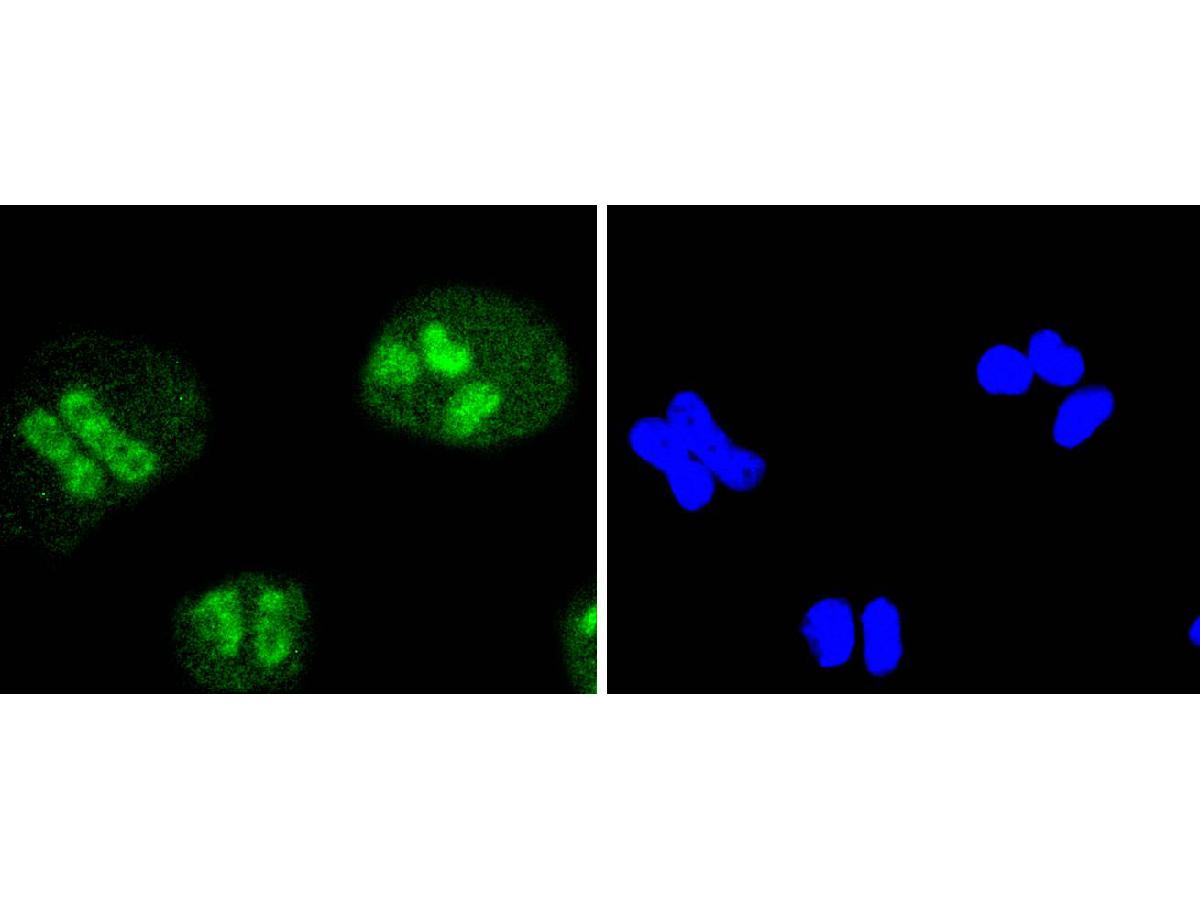 ICC staining of SIRT1 in NIH/3T3 cells (green). Formalin fixed cells were permeabilized with 0.1% Triton X-100 in TBS for 10 minutes at room temperature and blocked with 1% Blocker BSA for 15 minutes at room temperature. Cells were probed with the primary antibody (ET1603-3, 1/50) for 1 hour at room temperature, washed with PBS. Alexa Fluor®488 Goat anti-Rabbit IgG was used as the secondary antibody at 1/1,000 dilution. The nuclear counter stain is DAPI (blue).