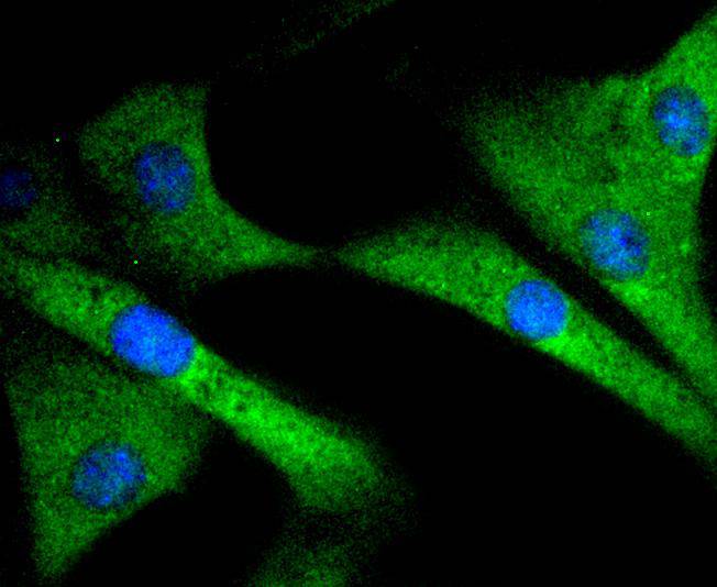 ICC staining of SIRT1 in SH-SY5Y cells (green). Formalin fixed cells were permeabilized with 0.1% Triton X-100 in TBS for 10 minutes at room temperature and blocked with 1% Blocker BSA for 15 minutes at room temperature. Cells were probed with the primary antibody (ET1603-3, 1/50) for 1 hour at room temperature, washed with PBS. Alexa Fluor®488 Goat anti-Rabbit IgG was used as the secondary antibody at 1/1,000 dilution. The nuclear counter stain is DAPI (blue).