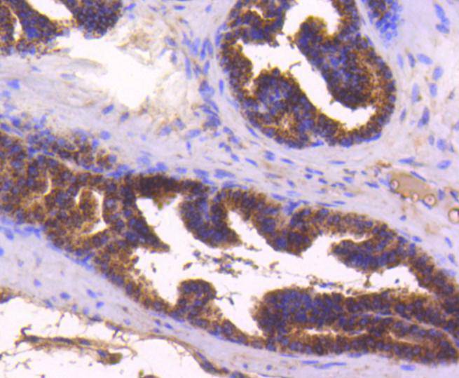 Immunohistochemical analysis of paraffin-embedded mouse prostate tissue using anti-Bax antibody. The section was pre-treated using heat mediated antigen retrieval with Tris-EDTA buffer (pH 8.0-8.4) for 20 minutes.The tissues were blocked in 5% BSA for 30 minutes at room temperature, washed with ddH2O and PBS, and then probed with the primary antibody (ET1603-34, 1/50) for 30 minutes at room temperature. The detection was performed using an HRP conjugated compact polymer system. DAB was used as the chromogen. Tissues were counterstained with hematoxylin and mounted with DPX.