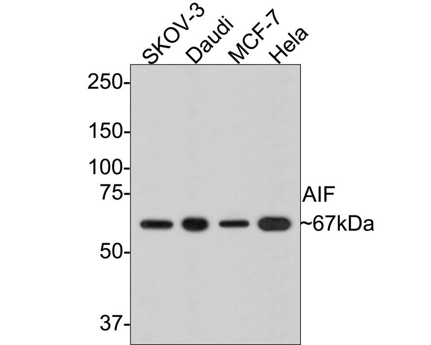 ICC staining of AIF in Hela cells (green). Formalin fixed cells were permeabilized with 0.1% Triton X-100 in TBS for 10 minutes at room temperature and blocked with 1% Blocker BSA for 15 minutes at room temperature. Cells were probed with the primary antibody (ET1603-4, 1/50) for 1 hour at room temperature, washed with PBS. Alexa Fluor®488 Goat anti-Rabbit IgG was used as the secondary antibody at 1/1,000 dilution. The nuclear counter stain is DAPI (blue).
