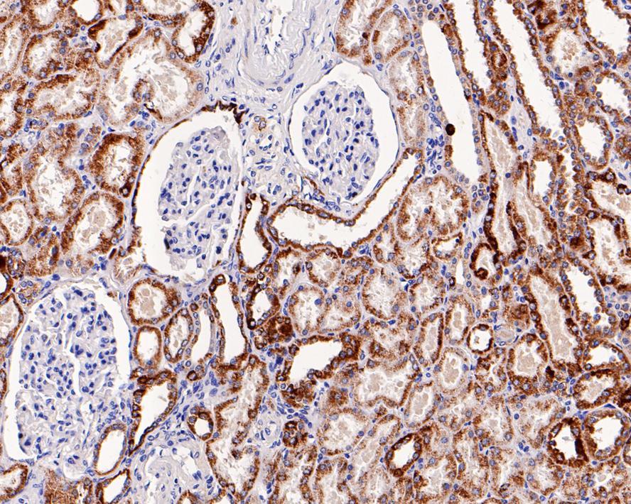 Immunohistochemical analysis of paraffin-embedded mouse liver tissue using anti-AIF antibody. The section was pre-treated using heat mediated antigen retrieval with Tris-EDTA buffer (pH 8.0-8.4) for 20 minutes.The tissues were blocked in 5% BSA for 30 minutes at room temperature, washed with ddH2O and PBS, and then probed with the primary antibody (ET1603-4, 1/50) for 30 minutes at room temperature. The detection was performed using an HRP conjugated compact polymer system. DAB was used as the chromogen. Tissues were counterstained with hematoxylin and mounted with DPX.