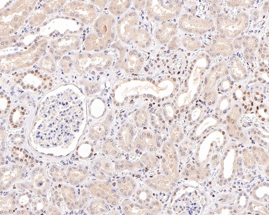 Immunohistochemical analysis of paraffin-embedded mouse skeletal muscle tissue using anti-Phospho-STAT3(Tyr705) antibody. The section was pre-treated using heat mediated antigen retrieval with Tris-EDTA buffer (pH 9.0) for 20 minutes.The tissues were blocked in 5% BSA for 30 minutes at room temperature, washed with ddH2O and PBS, and then probed with the primary antibody (ET1603-40, 1/50) for 30 minutes at room temperature. The detection was performed using an HRP conjugated compact polymer system. DAB was used as the chromogen. Tissues were counterstained with hematoxylin and mounted with DPX.