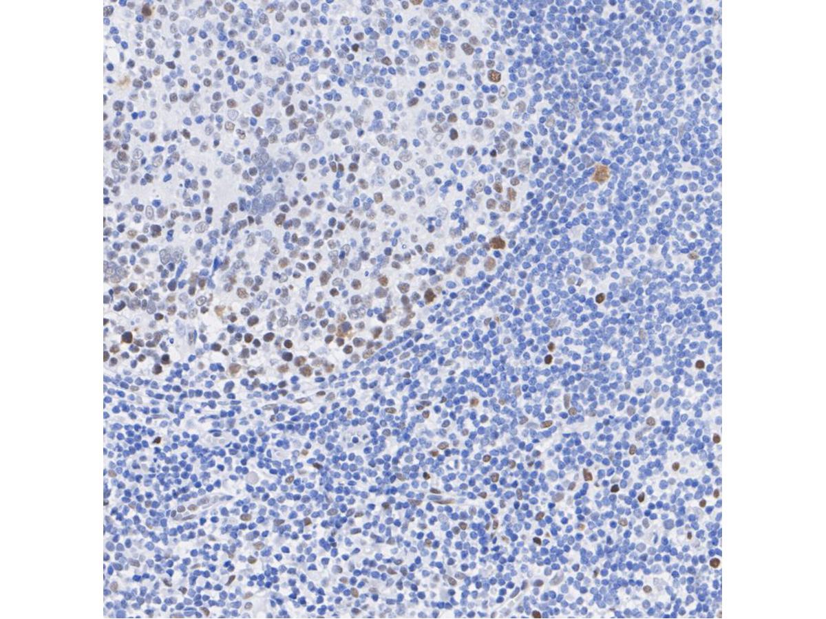 Phospho-V-Myb+C-Myb (S11) Recombinant Rabbit Monoclonal Antibody [SZ04-81] - image 2