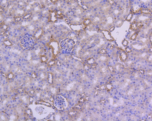 ICC staining of IKB alpha in MCF-7 cells (green). Formalin fixed cells were permeabilized with 0.1% Triton X-100 in TBS for 10 minutes at room temperature and blocked with 1% Blocker BSA for 15 minutes at room temperature. Cells were probed with the primary antibody (ET1603-6, 1/50) for 1 hour at room temperature, washed with PBS. Alexa Fluor®488 Goat anti-Rabbit IgG was used as the secondary antibody at 1/1,000 dilution. The nuclear counter stain is DAPI (blue).