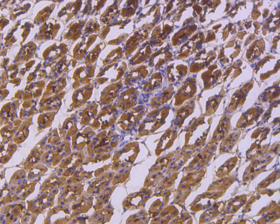 Immunohistochemical analysis of paraffin-embedded human kidney tissue using anti-IKB alpha antibody. The section was pre-treated using heat mediated antigen retrieval with Tris-EDTA buffer (pH 8.0-8.4) for 20 minutes.The tissues were blocked in 5% BSA for 30 minutes at room temperature, washed with ddH2O and PBS, and then probed with the primary antibody (ET1603-6, 1/50) for 30 minutes at room temperature. The detection was performed using an HRP conjugated compact polymer system. DAB was used as the chromogen. Tissues were counterstained with hematoxylin and mounted with DPX.