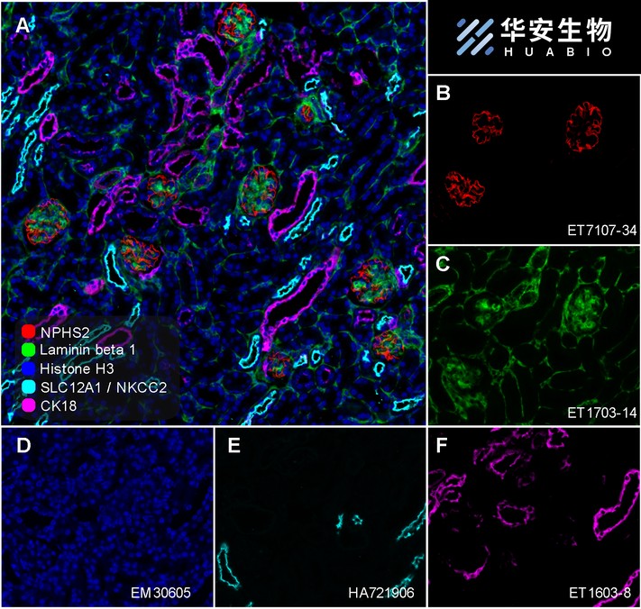 Immunocytochemistry analysis of A431 cells labeling<br />
Cytokeratin 18 with Rabbit anti-Cytokeratin 18 antibody (ET1603-8) at 1/100<br />
dilution.<br />
<br />
Formalin fixed cells were permeabilized with 0.1% Triton X-100 in TBS for 10 minutes at room temperature and blocked with 1% Blocker BSA for 15 minutes at room temperature. Cells were probed with the primary antibody (ET1603-8, 1/100) for 1 hour at room temperature, washed with PBS. Alexa Fluor®488 Goat anti-Rabbit IgG was used as the secondary antibody at 1/1,000 dilution. The nuclear counter stain is DAPI (blue).