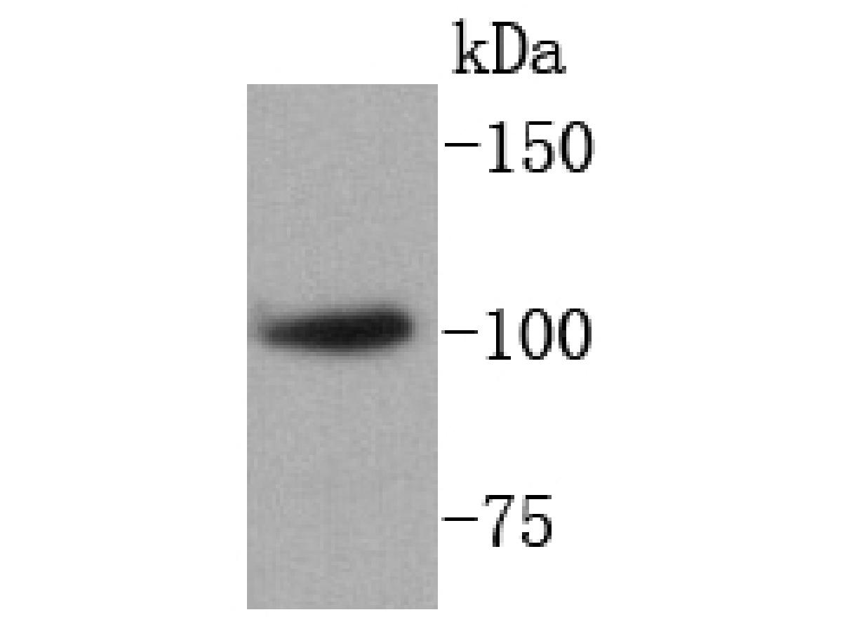 Western blot analysis of SATB1 on human thymus tissue lysates. <br />
<br />
Predicted band size:86 kDa<br />
Observed band size:100 kDa<br />
<br />
Exposure time:3 minutes;<br />
<br />
8% SDS-PAGE gel.<br />
<br />
Proteins were transferred to a PVDF membrane and blocked with 5% BSA in PBS for 1 hour at room temperature. The primary antibody (ET1604-10, 1/500) was used in 5% BSA at room temperature for 2 hours. Goat Anti-Rabbit IgG - HRP Secondary Antibody (HA1001) at 1:200,000 dilution was used for 1 hour at room temperature.