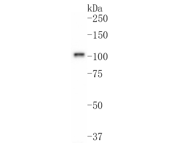 Western blot analysis of SATB1 on mouse thymus tissue lysates. <br />
<br />
Predicted band size:86 kDa<br />
Observed band size:100 kDa<br />
<br />
Exposure time:3 minutes;<br />
<br />
8% SDS-PAGE gel.<br />
<br />
Proteins were transferred to a PVDF membrane and blocked with 5% BSA in PBS for 1 hour at room temperature. The primary antibody (ET1604-10, 1/500) was used in 5% BSA at room temperature for 2 hours. Goat Anti-Rabbit IgG - HRP Secondary Antibody (HA1001) at 1:200,000 dilution was used for 1 hour at room temperature.
