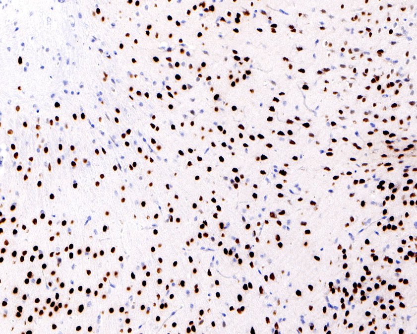Immunohistochemical analysis of paraffin-embedded mouse brain tissue using anti-SATB1 antibody. <br />
<br />
The section was pre-treated using heat mediated antigen retrieval with sodium citrate buffer (pH 6.0) for 20 minutes. The tissues were blocked in 5% BSA for 30 minutes at room temperature, washed with ddH2O and PBS, and then probed with the primary antibody (ET1604-10, 1/200)  for 30 minutes at room temperature. The detection was performed using an HRP conjugated compact polymer system. DAB was used as the chromogen. Tissues were counterstained with hematoxylin and mounted with DPX.