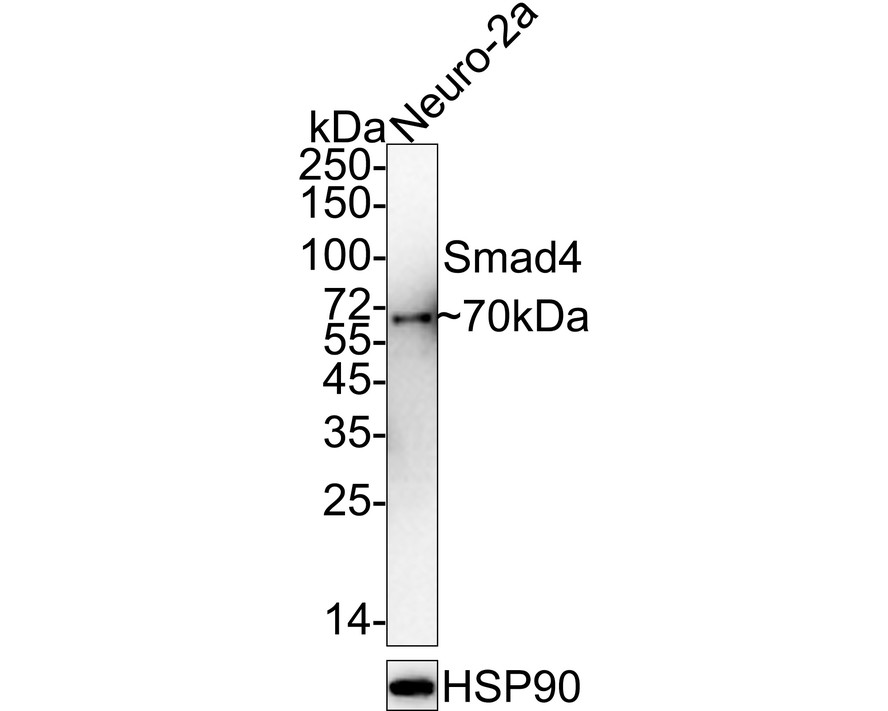 All lanes: Western blot analysis of Smad4 with anti-Smad4 antibody (ET1604-12) at 1:1,000 dilution.<br />
Lane 1: Wild-type HaCaT whole cell lysate (15 µg).<br />
Lane 2: Smad4 knockout HaCaT whole cell lysate (15 µg).<br />
<br />
ET1604-12 was shown to specifically react with Smad4 in wild-type HaCaT cells. NO band was observed when Smad4 knockout sample was tested. Wild-type and Smad4 knockout samples were subjected to SDS-PAGE. Proteins were transferred to a PVDF membrane and blocked with 5% NFDM in TBST for 1 hour at room temperature. The primary antibody (ET1604-12, 1:1,000) was used in 5% BSA at room temperature for 2 hours. Goat Anti-Rabbit IgG-HRP Secondary Antibody at 1:10,000 dilution was used for 1 hour at room temperature.