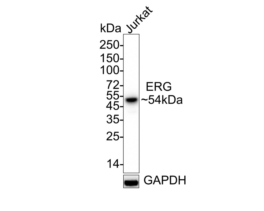 Western blot analysis of ERG on Jurkat cell lysates.<br />
<br />
Proteins were transferred to a PVDF membrane and blocked with 5% BSA in PBS for 1 hour at room temperature. The primary antibody (ET1604-21, 1/500) was used in 5% BSA at room temperature for 2 hours. Goat Anti-Rabbit IgG - HRP Secondary Antibody (HA1001) at 1:5,000 dilution was used for 1 hour at room temperature.