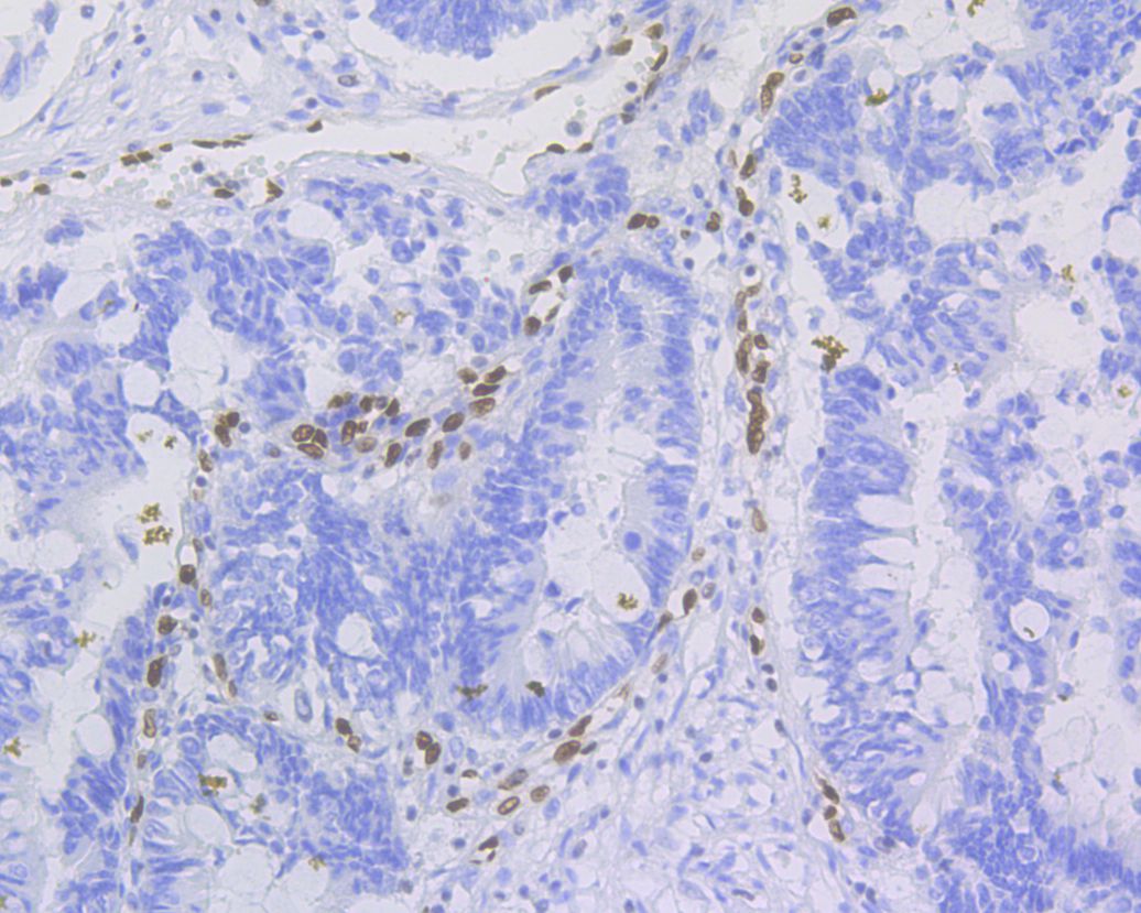 Immunohistochemical analysis of paraffin-embedded mouse brain tissue using anti-ERG antibody. <br />
<br />
The section was pre-treated using heat mediated antigen retrieval with sodium citrate buffer (pH 6.0) for 20 minutes. The tissues were blocked in 5% BSA for 30 minutes at room temperature, washed with ddH2O and PBS, and then probed with the primary antibody (ET1604-21, 1/100) for 30 minutes at room temperature. The detection was performed using an HRP conjugated compact polymer system. DAB was used as the chromogen. Tissues were counterstained with hematoxylin and mounted with DPX.