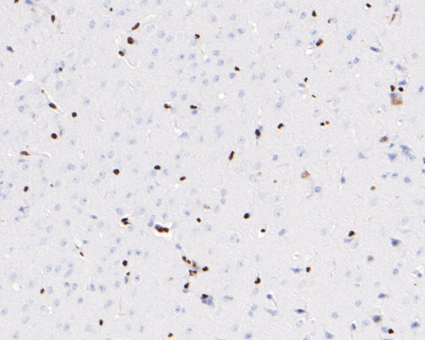 Immunohistochemical analysis of paraffin-embedded mouse heart tissue using anti-ERG antibody. <br />
<br />
The section was pre-treated using heat mediated antigen retrieval with sodium citrate buffer (pH 6.0) for 20 minutes. The tissues were blocked in 5% BSA for 30 minutes at room temperature, washed with ddH2O and PBS, and then probed with the primary antibody (ET1604-21, 1/100) for 30 minutes at room temperature. The detection was performed using an HRP conjugated compact polymer system. DAB was used as the chromogen. Tissues were counterstained with hematoxylin and mounted with DPX.