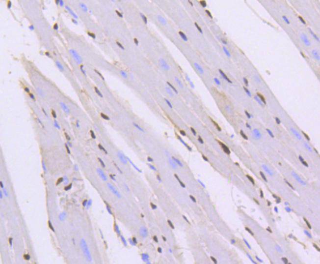 Immunohistochemical analysis of paraffin-embedded human spleen tissue using anti-ERG antibody. <br />
<br />
The section was pre-treated using heat mediated antigen retrieval with sodium citrate buffer (pH 6.0) for 20 minutes. The tissues were blocked in 5% BSA for 30 minutes at room temperature, washed with ddH2O and PBS, and then probed with the primary antibody (ET1604-21, 1/100) for 30 minutes at room temperature. The detection was performed using an HRP conjugated compact polymer system. DAB was used as the chromogen. Tissues were counterstained with hematoxylin and mounted with DPX.