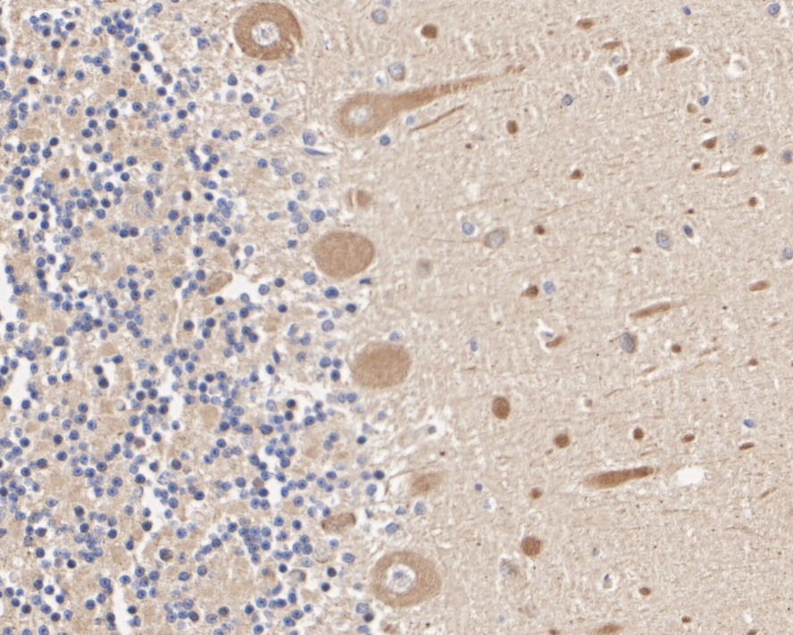 ICC staining of Smad2 in HepG2 cells (green). <br />
<br />
Formalin fixed cells were permeabilized with 0.1% Triton X-100 in TBS for 10 minutes at room temperature and blocked with 1% Blocker BSA for 15 minutes at room temperature. Cells were probed with the primary antibody (ET1604-22, 1/50) for 1 hour at room temperature, washed with PBS. Alexa Fluor®488 Goat anti-Rabbit IgG was used as the secondary antibody at 1/1,000 dilution. The nuclear counter stain is DAPI (blue).