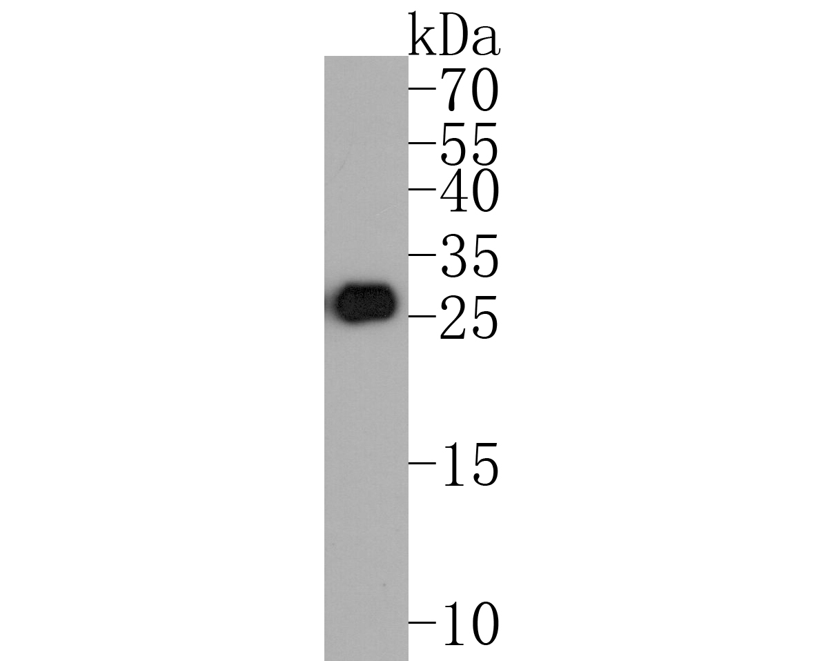 Western blot analysis of GFP on K562 cell lysates transfected with GFP. <br />
<br />
Proteins were transferred to a PVDF membrane and blocked with 5% BSA in PBS for 1 hour at room temperature. The primary antibody (ET1604-26, 1/1,000) was used in 5% BSA at room temperature for 2 hours. Goat Anti-Rabbit IgG - HRP Secondary Antibody (HA1001) at 1:5,000 dilution was used for 1 hour at room temperature.
