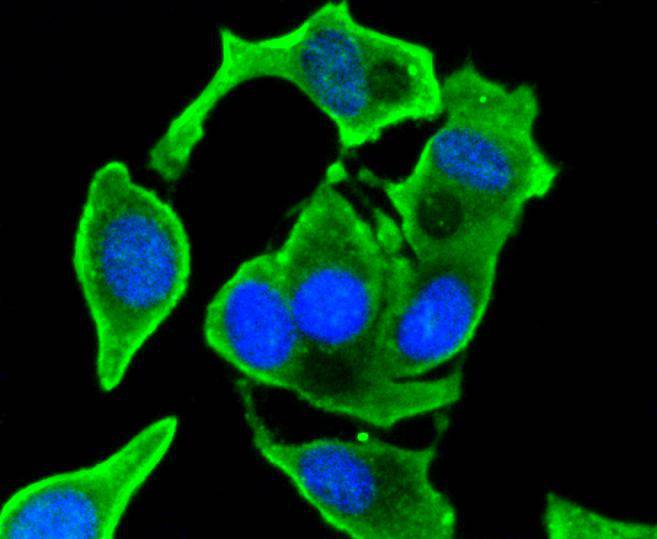 ICC staining of VEGF in Hela cells (green). Formalin fixed cells were permeabilized with 0.1% Triton X-100 in TBS for 10 minutes at room temperature and blocked with 1% Blocker BSA for 15 minutes at room temperature. Cells were probed with the primary antibody (ET1604-28, 1/50) for 1 hour at room temperature, washed with PBS. Alexa Fluor®488 Goat anti-Rabbit IgG was used as the secondary antibody at 1/1,000 dilution. The nuclear counter stain is DAPI (blue).