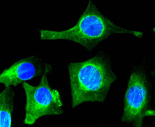 ICC staining of VEGF in SHG-44 cells (green). Formalin fixed cells were permeabilized with 0.1% Triton X-100 in TBS for 10 minutes at room temperature and blocked with 1% Blocker BSA for 15 minutes at room temperature. Cells were probed with the primary antibody (ET1604-28, 1/50) for 1 hour at room temperature, washed with PBS. Alexa Fluor®488 Goat anti-Rabbit IgG was used as the secondary antibody at 1/1,000 dilution. The nuclear counter stain is DAPI (blue).