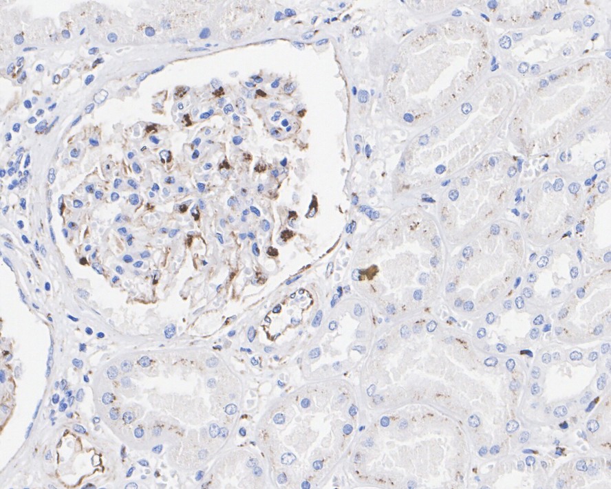 ICC staining of VEGF in SH-SY5Y cells (green). Formalin fixed cells were permeabilized with 0.1% Triton X-100 in TBS for 10 minutes at room temperature and blocked with 1% Blocker BSA for 15 minutes at room temperature. Cells were probed with the primary antibody (ET1604-28, 1/50) for 1 hour at room temperature, washed with PBS. Alexa Fluor®488 Goat anti-Rabbit IgG was used as the secondary antibody at 1/1,000 dilution. The nuclear counter stain is DAPI (blue).