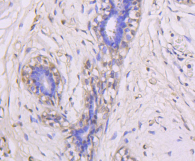 Immunohistochemical analysis of paraffin-embedded human breast tissue using anti-ERK1 antibody. The section was pre-treated using heat mediated antigen retrieval with Tris-EDTA buffer (pH 9.0) for 20 minutes.The tissues were blocked in 1% BSA for 30 minutes at room temperature, washed with ddH2O and PBS, and then probed with the primary antibody (ET1604-32, 1/50) for 30 minutes at room temperature. The detection was performed using an HRP conjugated compact polymer system. DAB was used as the chromogen. Tissues were counterstained with hematoxylin and mounted with DPX.