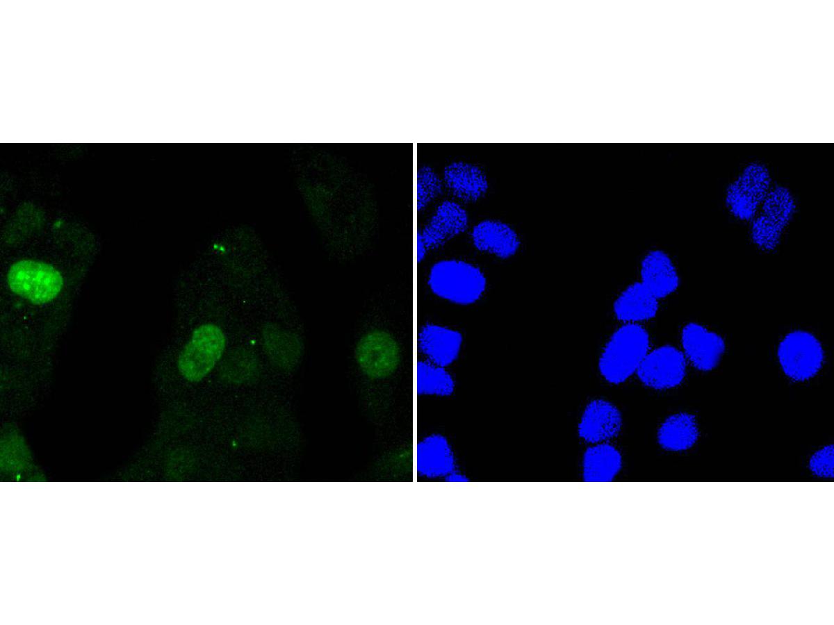 ICC staining of Survivin in Hela cells (green). Formalin fixed cells were permeabilized with 0.1% Triton X-100 in TBS for 10 minutes at room temperature and blocked with 1% Blocker BSA for 15 minutes at room temperature. Cells were probed with the primary antibody (ET1604-34, 1/50) for 1 hour at room temperature, washed with PBS. Alexa Fluor®488 Goat anti-Rabbit IgG was used as the secondary antibody at 1/1,000 dilution. The nuclear counter stain is DAPI (blue).